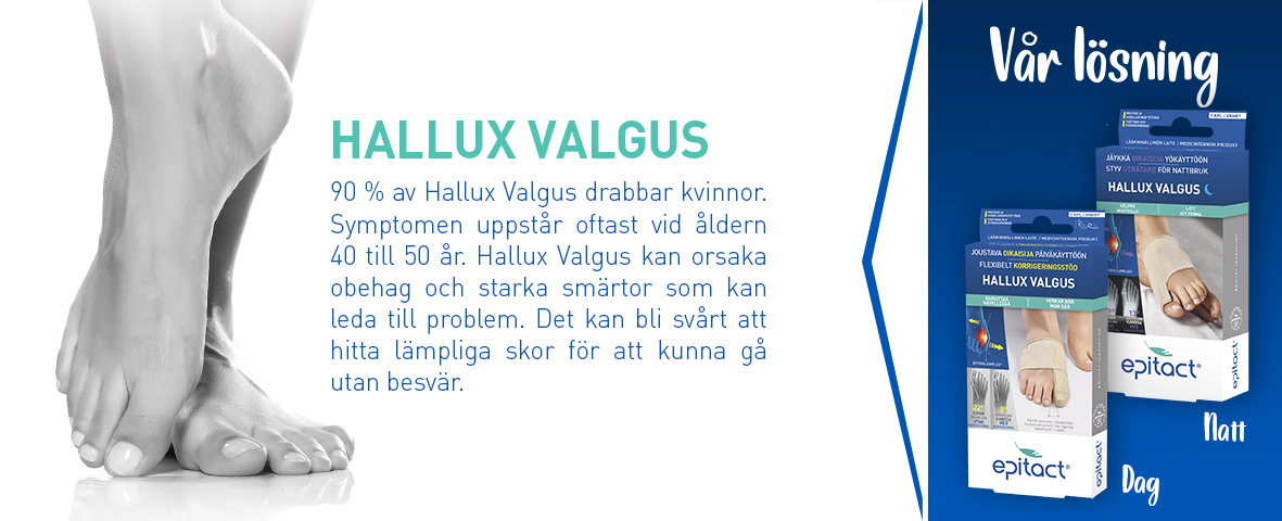 Hallux Valgus